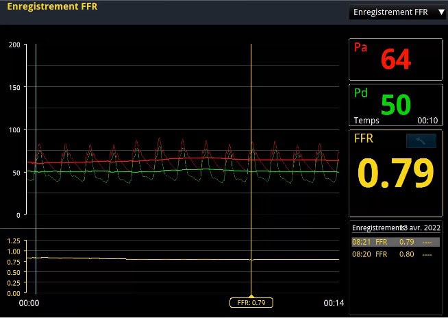 Hemodynamic Assessment and Coronary Physiology